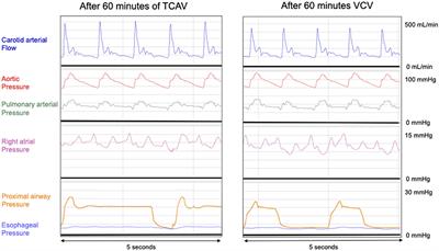 Time-Controlled Adaptive Ventilation Does Not Induce Hemodynamic Impairment in a Swine ARDS Model